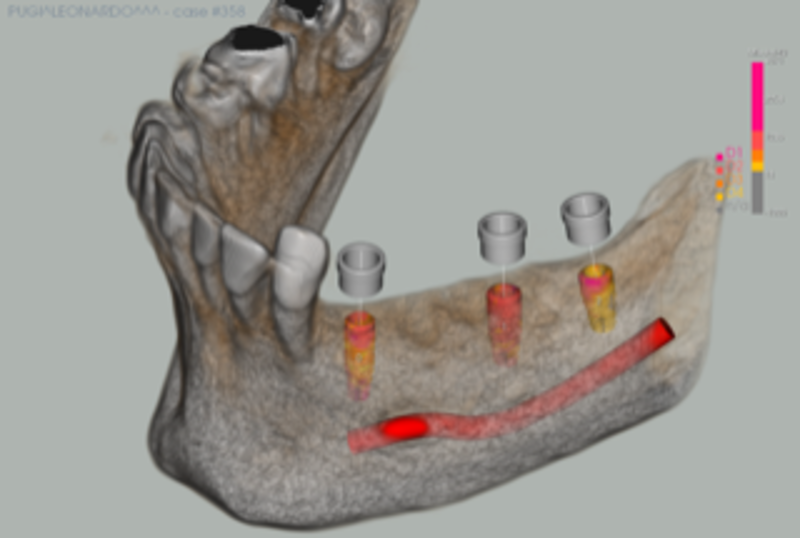 Progettazione Bnx 3d Guide 3